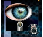 Гибкий видео уретроцистоскоп/нефроскоп EyeMAX CCD 
