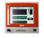 ANI Monitor - cистема непрерывного мониторинга обезболивания