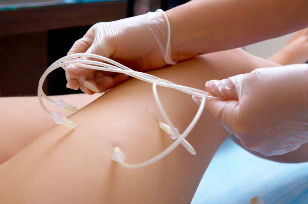 apparaty-ozonoterapii.jpg apparaty-ozonoterapii.jpg